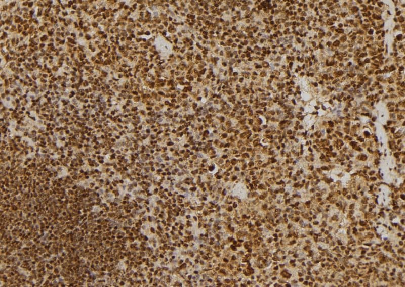 Polyclonal Rabbit anti-Human NUMA1 / NUMA Antibody (IHC, IF, WB)