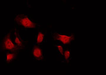 Polyclonal Rabbit anti-Human NUMA1 / NUMA Antibody (IHC, IF, WB)