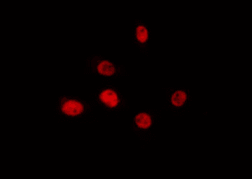 Polyclonal Rabbit anti-Human PRPF39 Antibody (IF, WB)