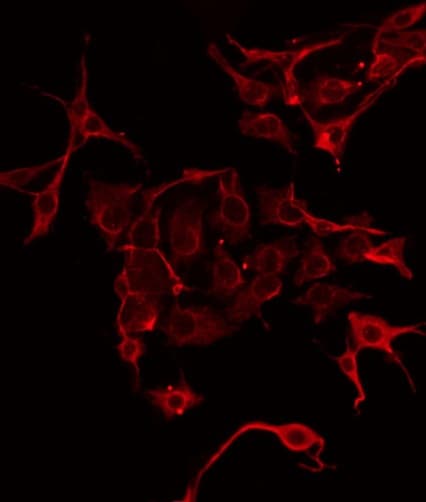 Polyclonal Rabbit anti-Human CPA1 / Carboxypeptidase A Antibody (IHC, IF, WB)