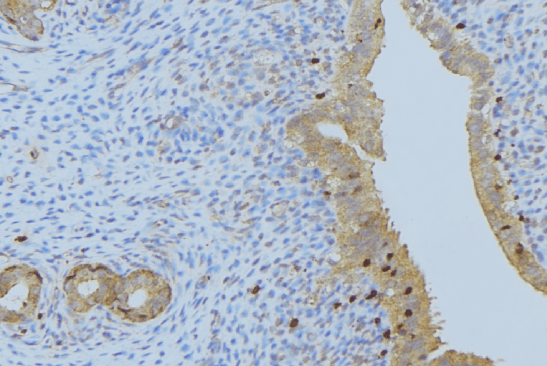 Polyclonal Rabbit anti-Human CPA1 / Carboxypeptidase A Antibody (IHC, IF, WB)