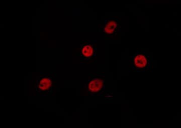 Polyclonal Rabbit anti-Human Histone H4 Antibody (IHC, IF, WB)