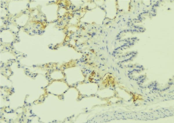 Polyclonal Rabbit anti-Human EDNRA / Endothelin A Receptor Antibody (IHC, IF, WB)