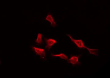 Polyclonal Rabbit anti-Human EDNRA / Endothelin A Receptor Antibody (IHC, IF, WB)