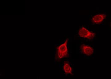 Anopheles gambiae GPROPDR Antibody