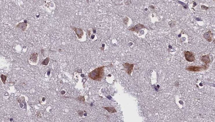 Polyclonal Rabbit anti-Human CASP10 / Caspase 10 Antibody (IHC, WB)