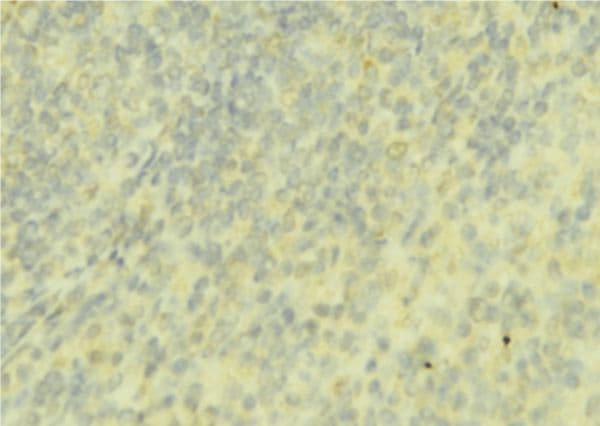Polyclonal Rabbit anti-Human F9 / Factor IX Antibody (IHC, WB)