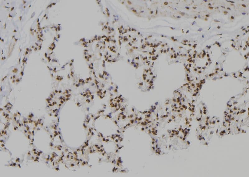 Polyclonal Rabbit anti-Human PSMC2 / RPT1 Antibody (IHC, IF, WB)
