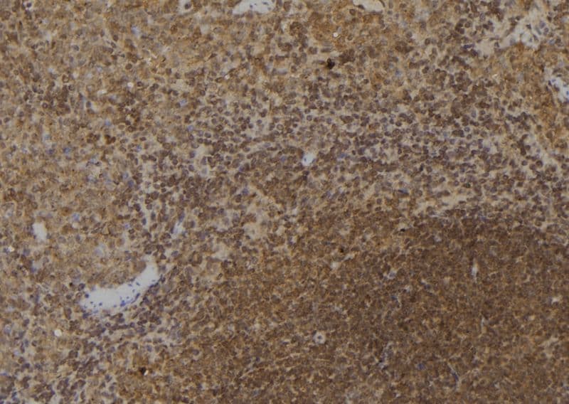 Polyclonal Rabbit anti-Human LTA4H / LTA4 Antibody (IHC, WB)