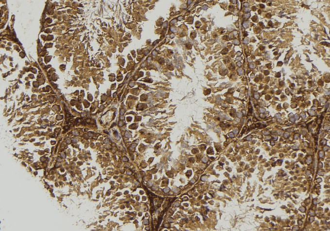 Polyclonal Rabbit anti-Human TPP1 / CLN2 Antibody (IHC, WB)