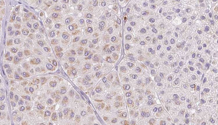 Polyclonal Rabbit anti-Human PLAT / TPA Antibody (IHC, IF, WB)