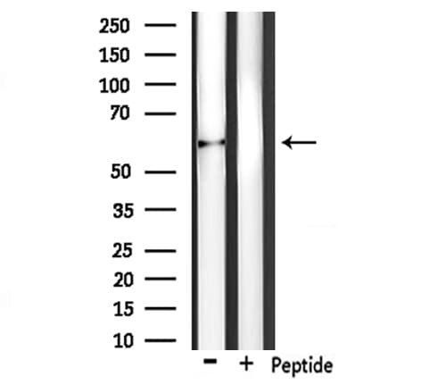Polyclonal Rabbit anti-Human PLAT / TPA Antibody (IHC, IF, WB)