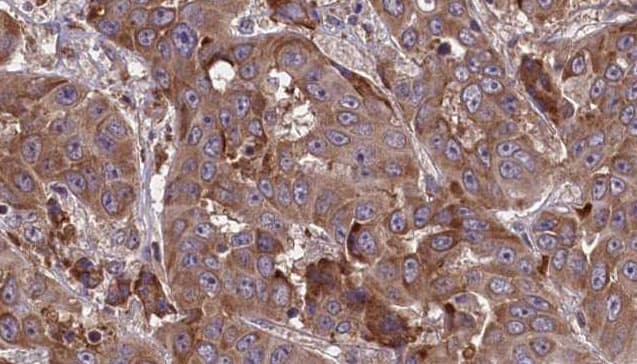 Polyclonal Rabbit anti-Human SLC3A2 / CD98 Heavy Chain Antibody (aa159-184, IHC, WB)