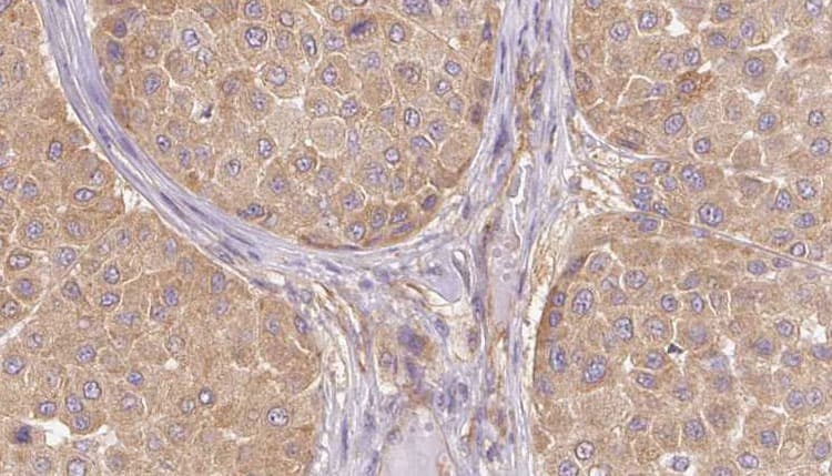Polyclonal Rabbit anti-Human VEGFA / VEGF Antibody (IHC, WB)