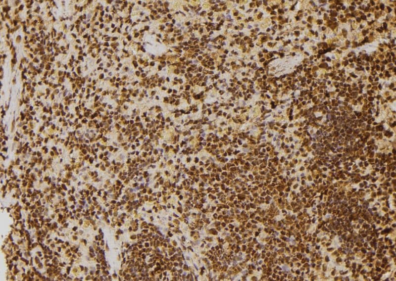Polyclonal Rabbit anti-Human TP53BP1 / 53BP1 Antibody (IHC, IF, WB)