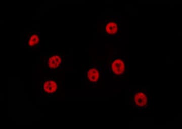 Polyclonal Rabbit anti-Human TP53BP1 / 53BP1 Antibody (IHC, IF, WB)