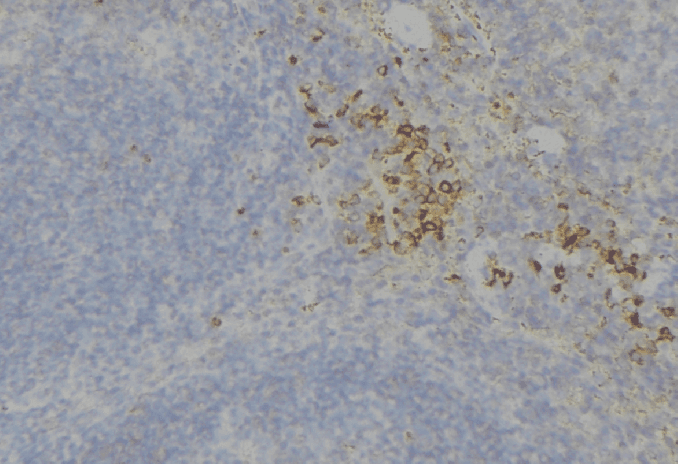 Polyclonal Rabbit anti-Human TEK / TIE2 Antibody (IHC, WB)