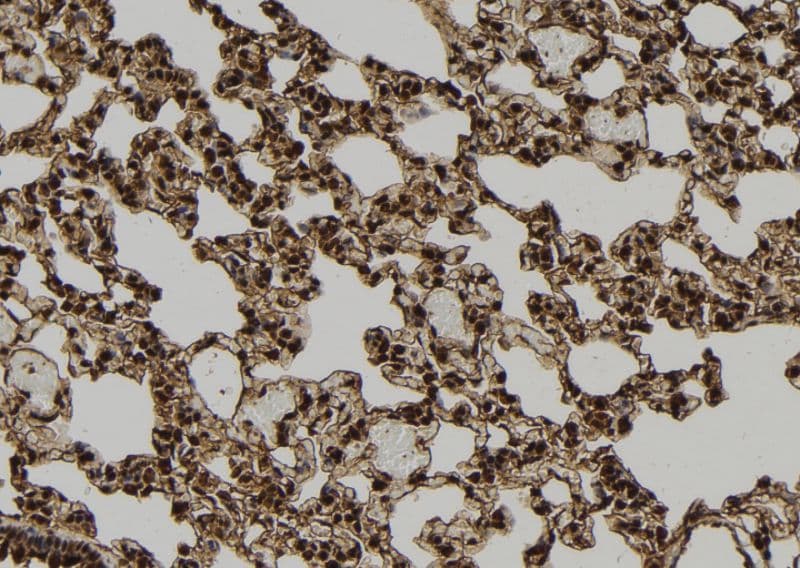 Polyclonal Rabbit anti-Human TXNIP Antibody (IHC, WB)