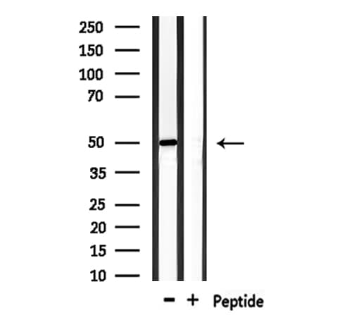 Polyclonal Rabbit anti-Human TXNIP Antibody (IHC, WB)