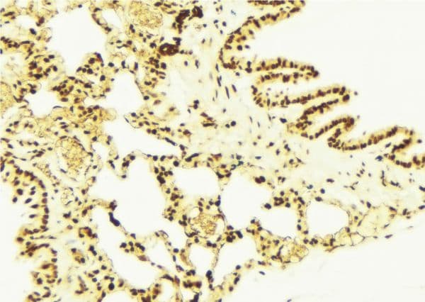 Polyclonal Rabbit anti-Human NFE2L2 / NRF2 Antibody (phospho-Ser40, IHC, IF, WB)