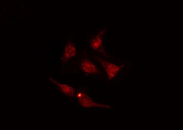 Polyclonal Rabbit anti-Human NFE2L2 / NRF2 Antibody (phospho-Ser40, IHC, IF, WB)