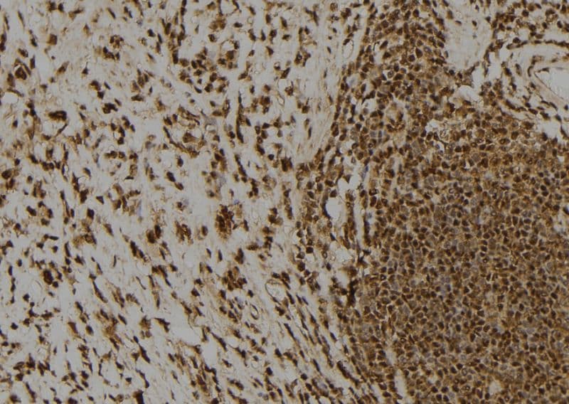 CLSPN / Claspin Antibody