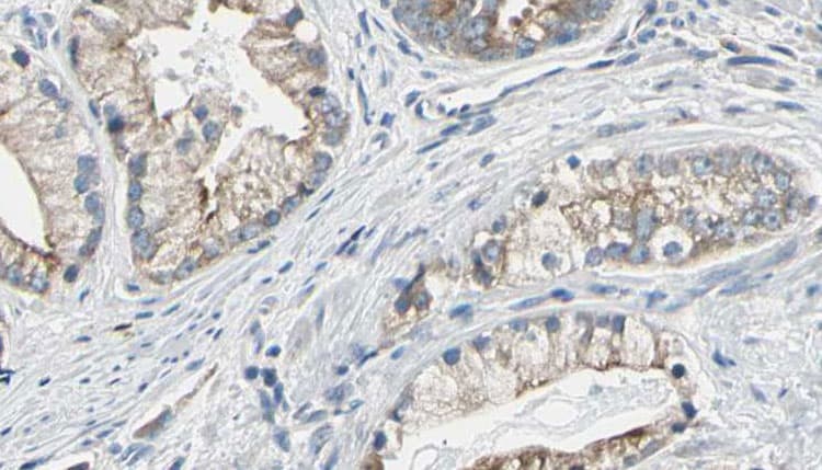 Polyclonal Rabbit anti-Human IRS2 / IRS-2 Antibody (IHC, WB)