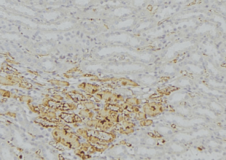 Polyclonal Rabbit anti-Human CAT / Catalase Antibody (IHC, IF, WB)