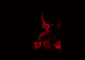 Polyclonal Rabbit anti-Human CAT / Catalase Antibody (IHC, IF, WB)