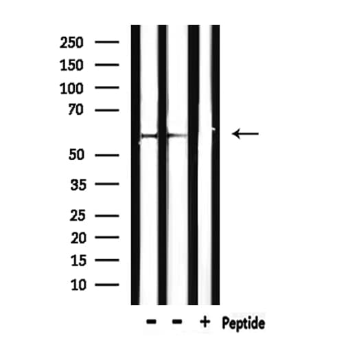 Polyclonal Rabbit anti-Human CAT / Catalase Antibody (IHC, IF, WB)