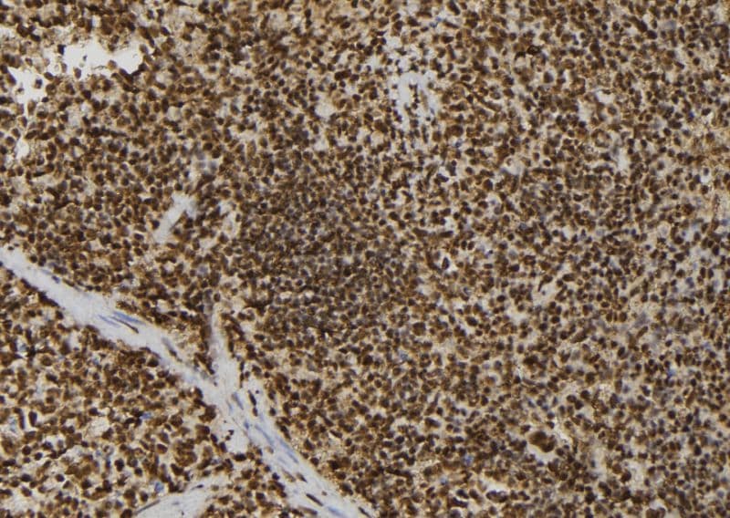 Polyclonal Rabbit anti-Human CSNK2B / Phosvitin Antibody (IHC, IF, WB)