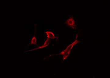 Polyclonal Rabbit anti-Human CSNK2B / Phosvitin Antibody (IHC, IF, WB)
