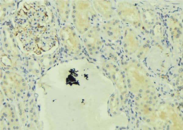 ULK1 Antibody (phospho-Ser556)