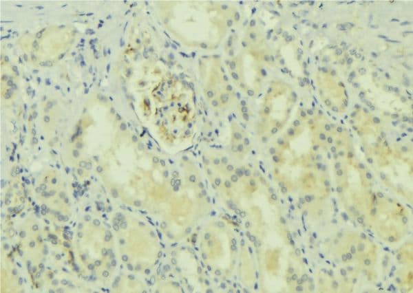 Polyclonal Rabbit anti-Human ULK1 Antibody (aa542-565, IHC, WB)