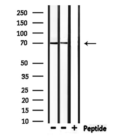 Polyclonal Rabbit anti-Human BACE1 / BACE Antibody (WB)