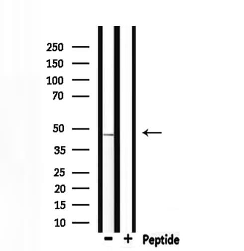 Polyclonal Rabbit anti-Human PLIN2 / ADFP / Adipophilin Antibody (WB)