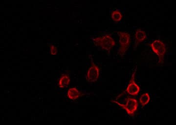 Polyclonal Rabbit anti-Human LAT Antibody (IF, WB)