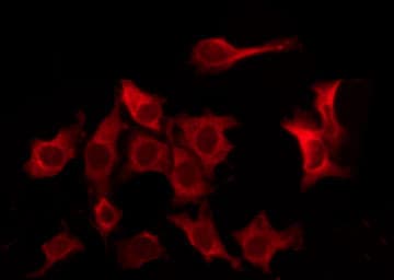 Polyclonal Rabbit anti-Human CD32B Antibody (IF, WB)