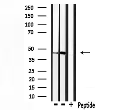 Polyclonal Rabbit anti-Human IHH Antibody (WB)