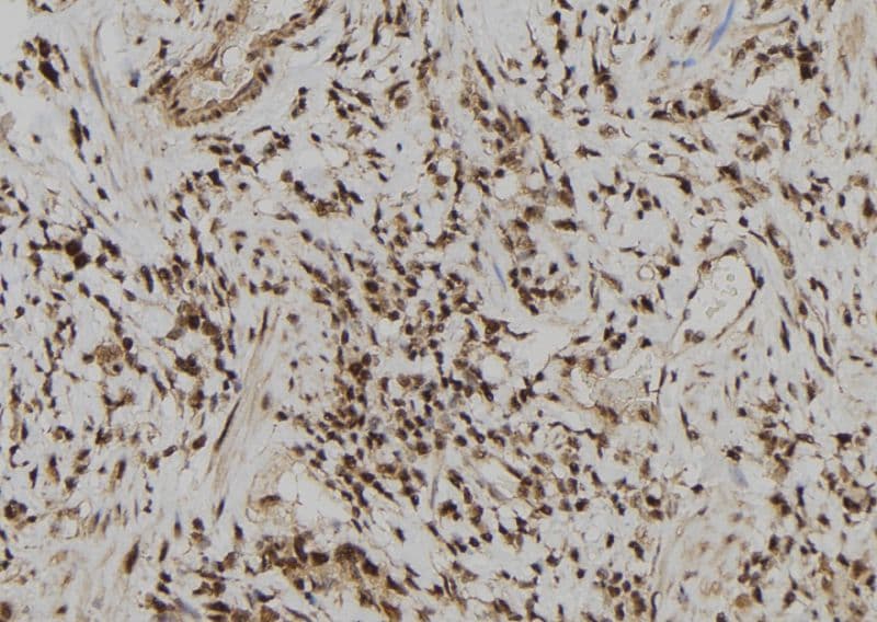 Polyclonal Rabbit anti-Human ERG Antibody (IHC, IF, WB)
