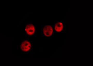 Polyclonal Rabbit anti-Human ERG Antibody (IHC, IF, WB)