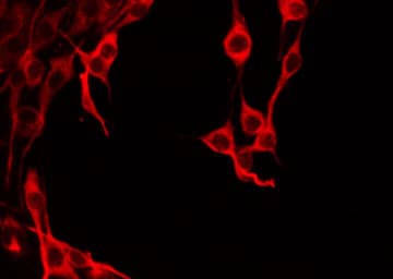 Polyclonal Rabbit anti-Human IAPP / Amylin Antibody (IHC, IF, WB)