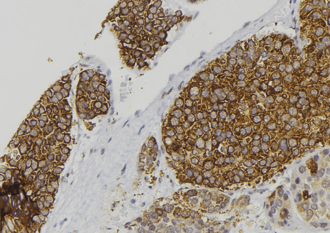 Polyclonal Rabbit anti-Human IAPP / Amylin Antibody (IHC, IF, WB)