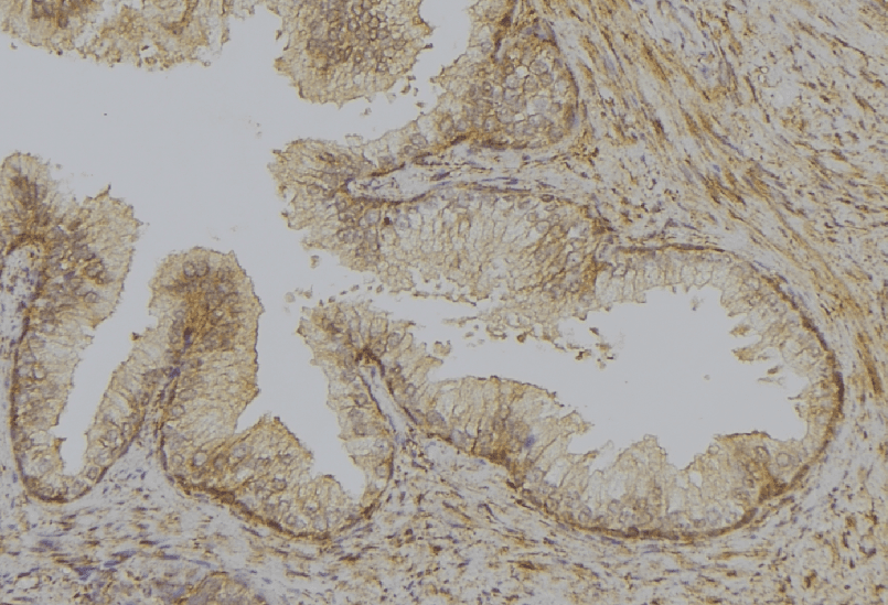 Polyclonal Rabbit anti-Human UCP1 / UCP-1 Antibody (IHC, WB)