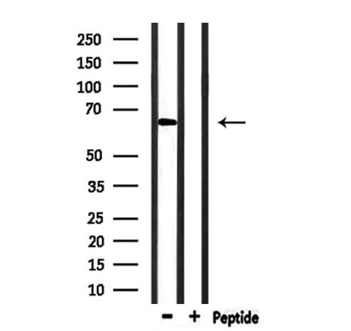 Polyclonal Rabbit anti-Human PINK1 Antibody (IHC, IF, WB)