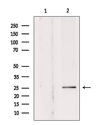 Polyclonal Rabbit anti-Human SOD3 Antibody (IF, WB)