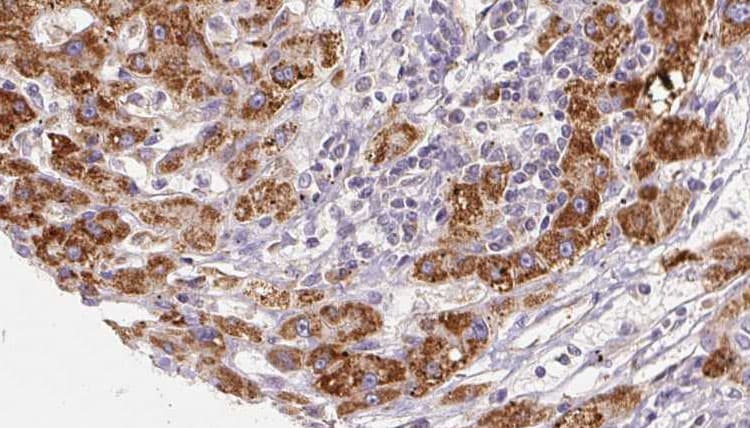 Polyclonal Rabbit anti-Human PNPLA2 / ATGL Antibody (IHC, IF, WB)