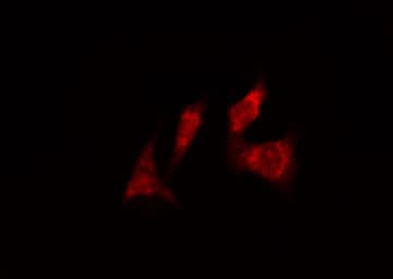 Polyclonal Rabbit anti-Human CDC6 Antibody (IF, WB)