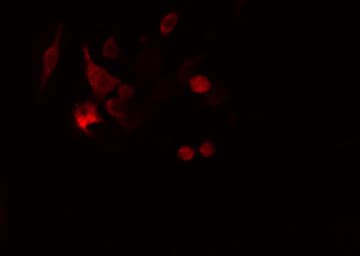 Polyclonal Rabbit anti-Human CALB2 / Calretinin Antibody (IF, WB)