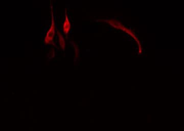 Polyclonal Rabbit anti-Human GC / Vitamin D-Binding Protein Antibody (IF, WB)